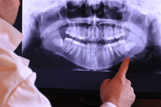 Best Dentist for Severe Toothache  in Patterson, LA