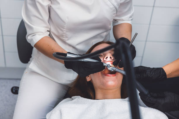 Emergency Dental Filling Replacement in LA