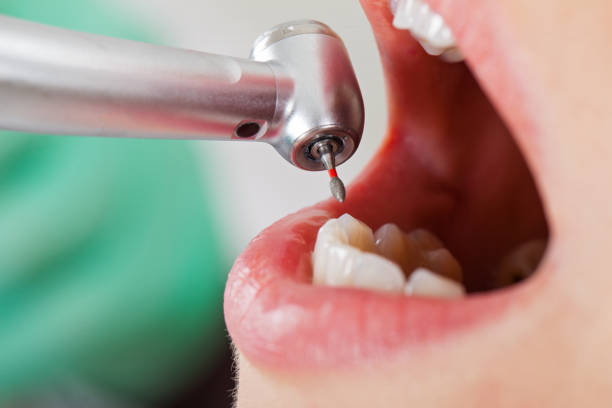 Best Tooth Pain Emergency Relief  in Patterson, LA